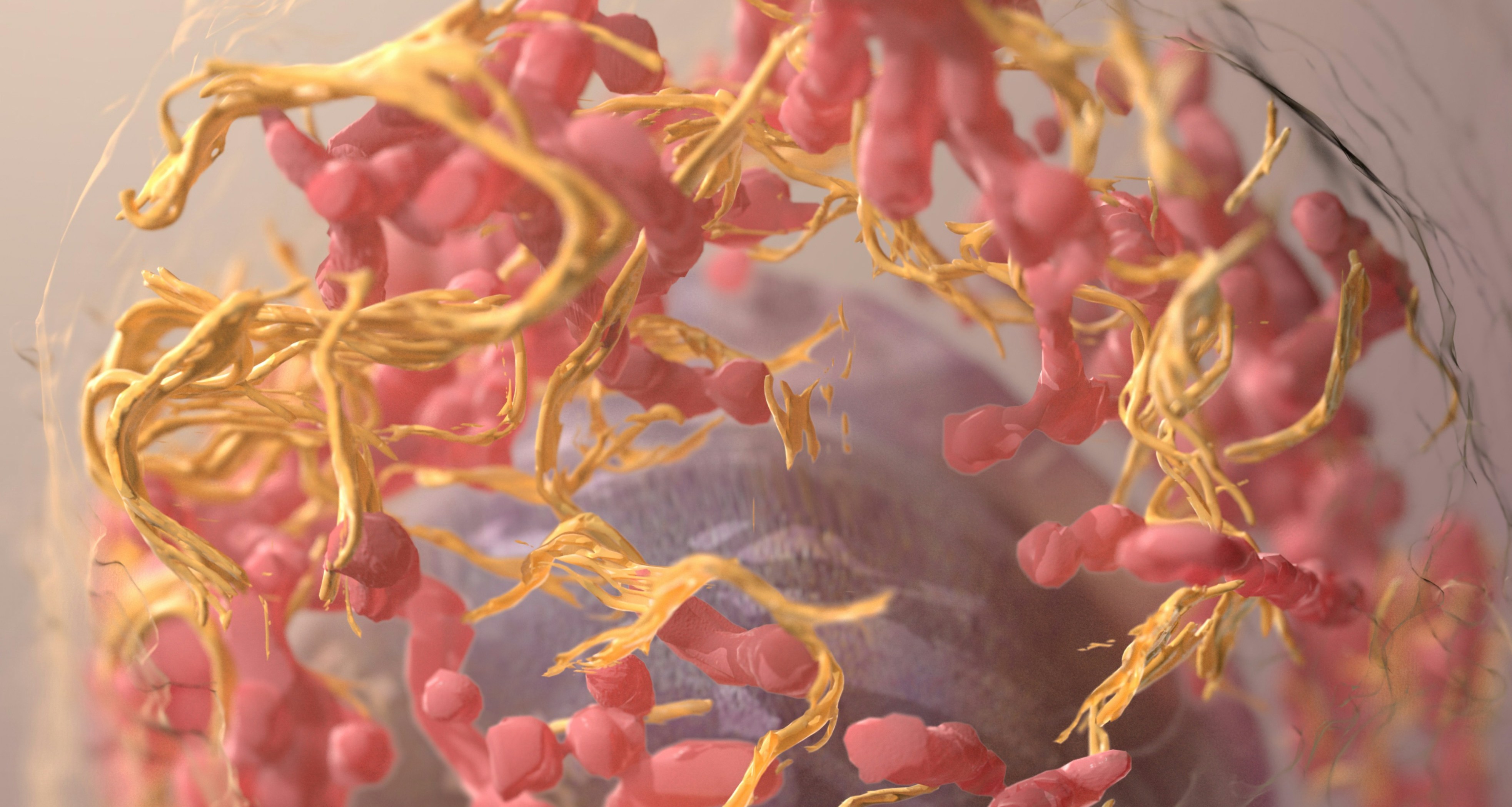 Profilul de Țară privind Cancerul - Romania 2023